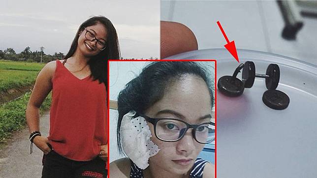 Hati-hati! Pakai Anting Harga Rp.15 Ribu, Cewek Ini Harus Alami Nasib Mengerikan, Lihat Telinganya!