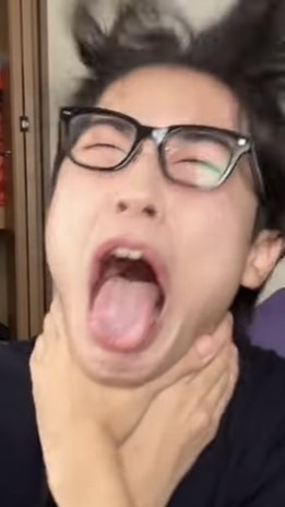 奇病の女の子たち
