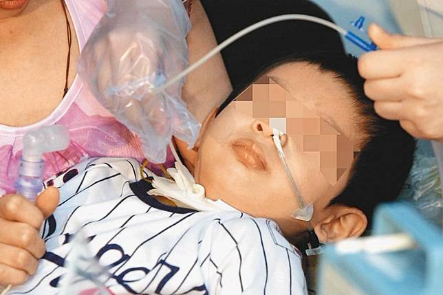 腸病毒重症 病發3天死亡