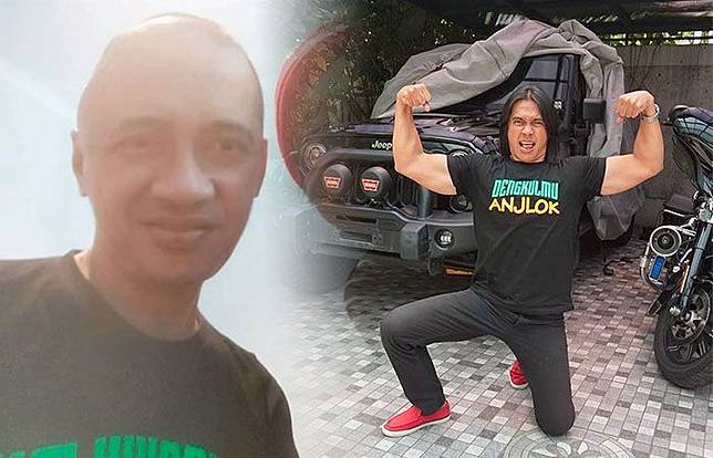 Komedian dan penyanyi Agung Hercules disebut mengidap penyakit Glioblastoma, tumor ganas yang berpotensi menjadi kanker.