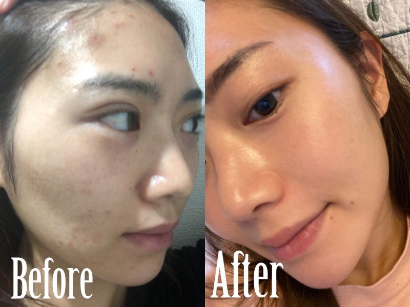 肌がすごくキレイだね と 本当にめちゃくちゃ褒められるようになりました Ar Web