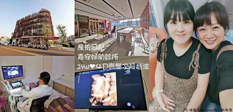 嘉義產檢x嘉安婦幼診所x4D高層次超音波檢查