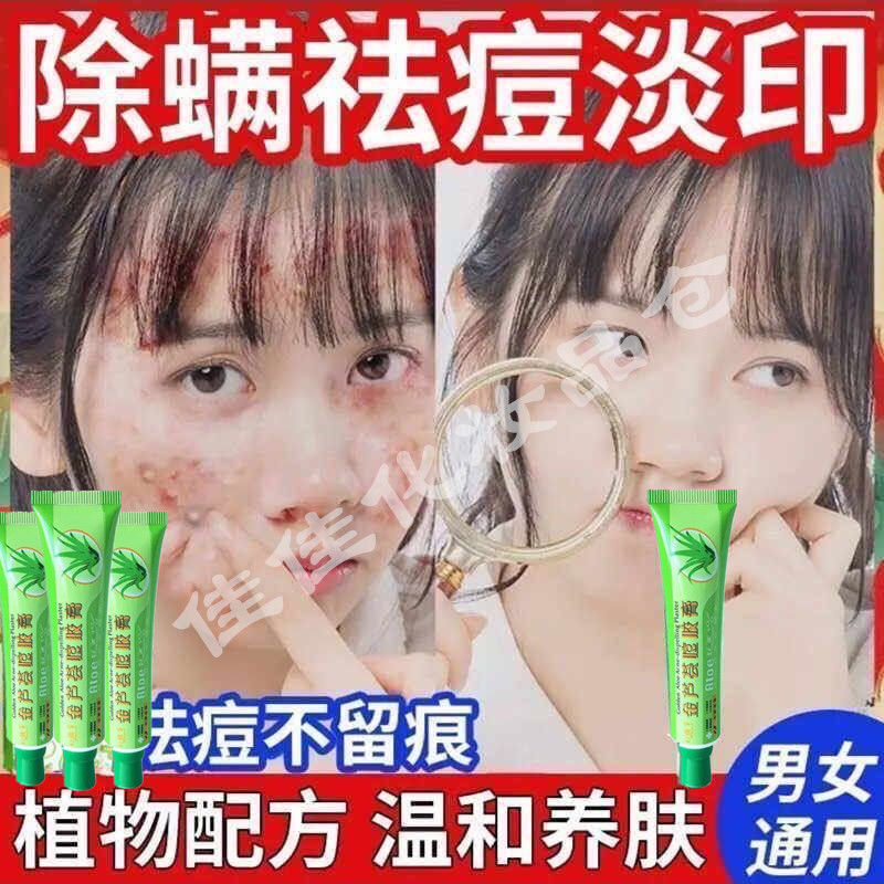 [強效]蘆薈祛痘膏蘆薈膠淡化痘印修復痘印祛痘疤學生祛痘男女通用
