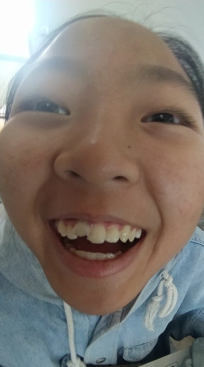 โอแพนแชทแต้แว่ด