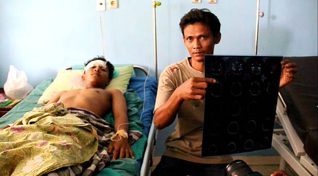 Anak Panah Tancap Kening, Pelajar SMK Terancam Gagal Ikut UN