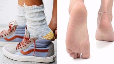 夏天腳臭好尷尬？特搜「 5 招擊退大法 」惡臭退散！