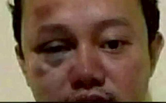 Hoaks foto Herry Wirawan atau HW, pemerkosa 12 santriwati di Bandung, disebut mengalami babak belur di penjara/Twitter.