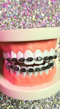 รีเทนเนอร์เเละสินค้าตามกระเเส
