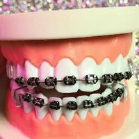 รีเทนเนอร์เเละสินค้าตามกระเเส