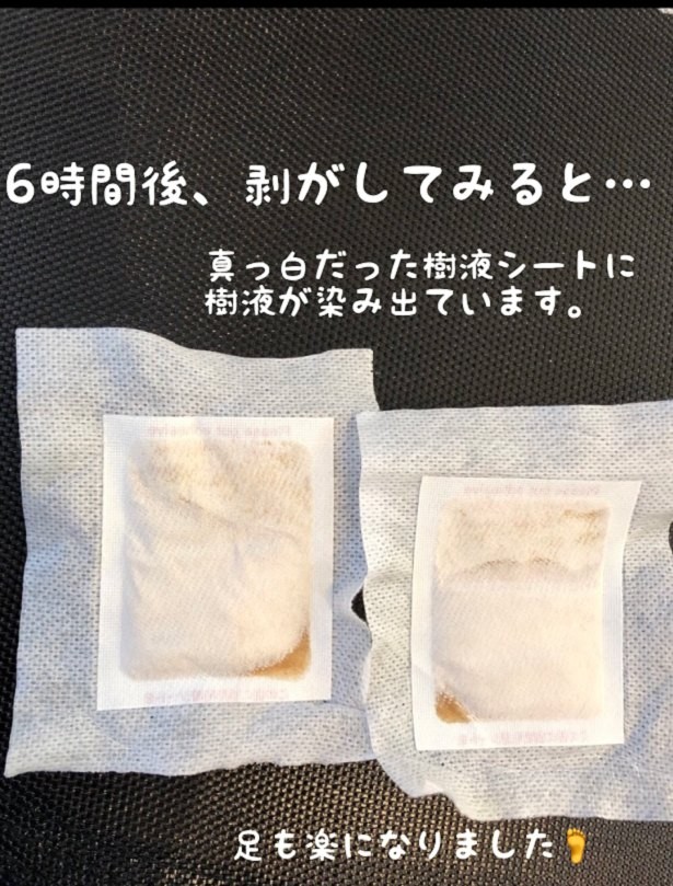 足のむくみをスッキリ解消 ダイソー 足裏樹液シート