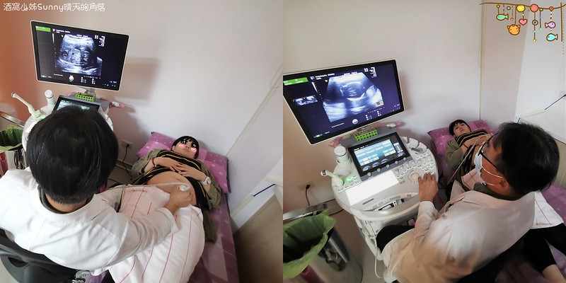 嘉義產檢x嘉安婦幼診所x4D高層次超音波檢查