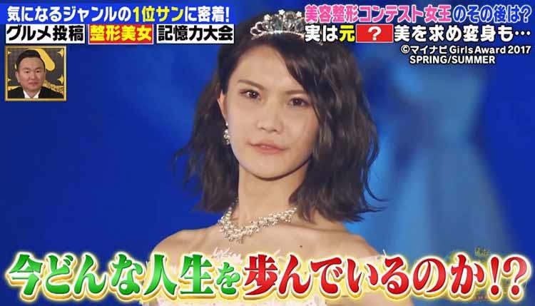 整形シンデレラ 1位サンのその後を徹底取材