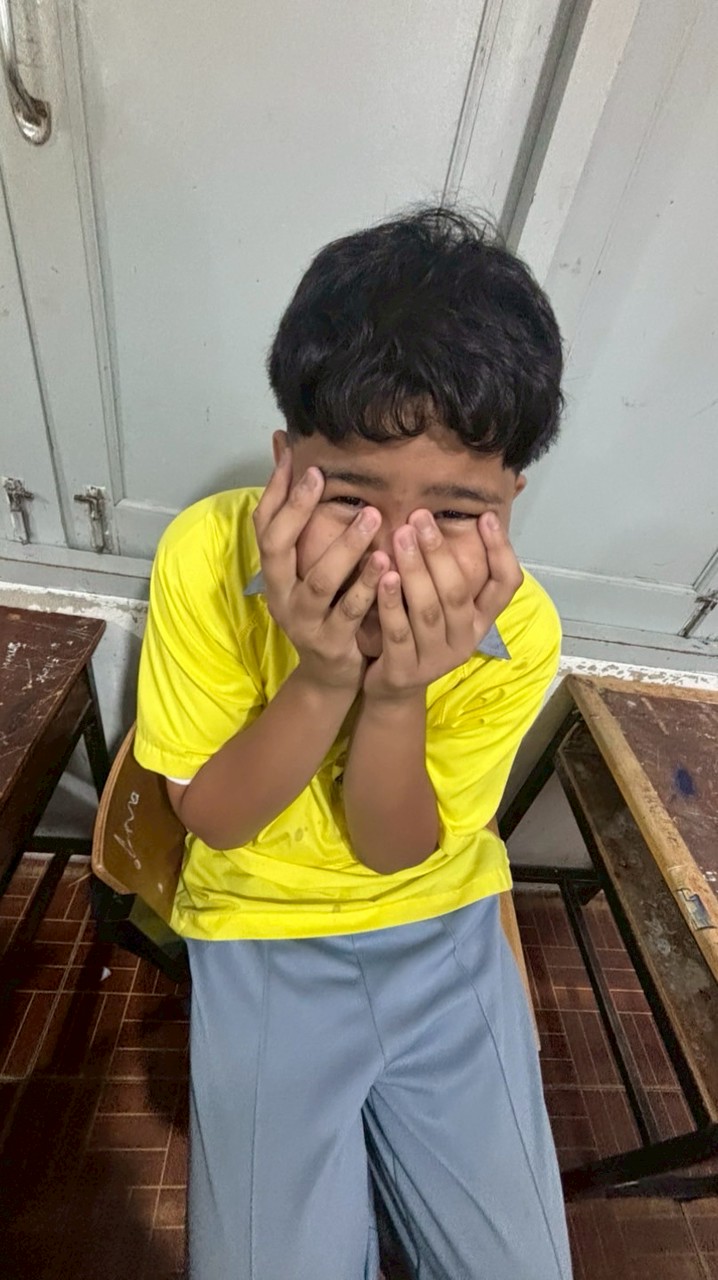 ด้อม ผมสามเส้น🤓