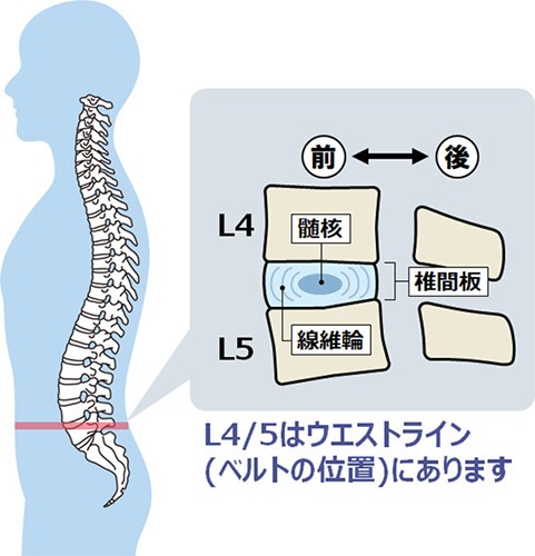 腰痛予防に 腰に負担をかけない姿勢とハリ胸スクワットのやり方