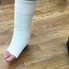 ギプスフェチの人集合(なかなかこのフェチって言えないですよね。。)