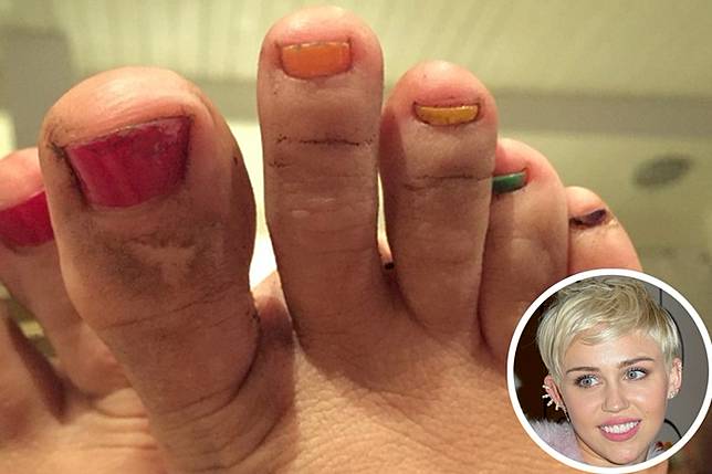 Iyuh, Kaki 13 Seleb Dunia Ini Nggak Semulus Wajahnya, Nomor 7 Paling Bikin Ilfeel!