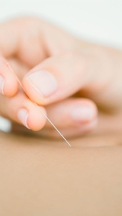 笑う鍼灸学生のオープンチャット
