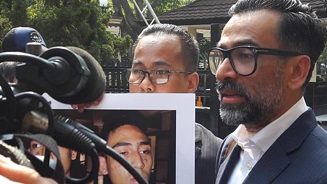 Video Anak Jeremy Thomas dengan Wajah Tampak Memar Jadi Viral