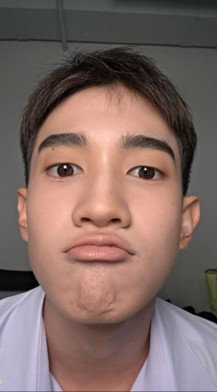 ปสอย.ฟิค ภภ