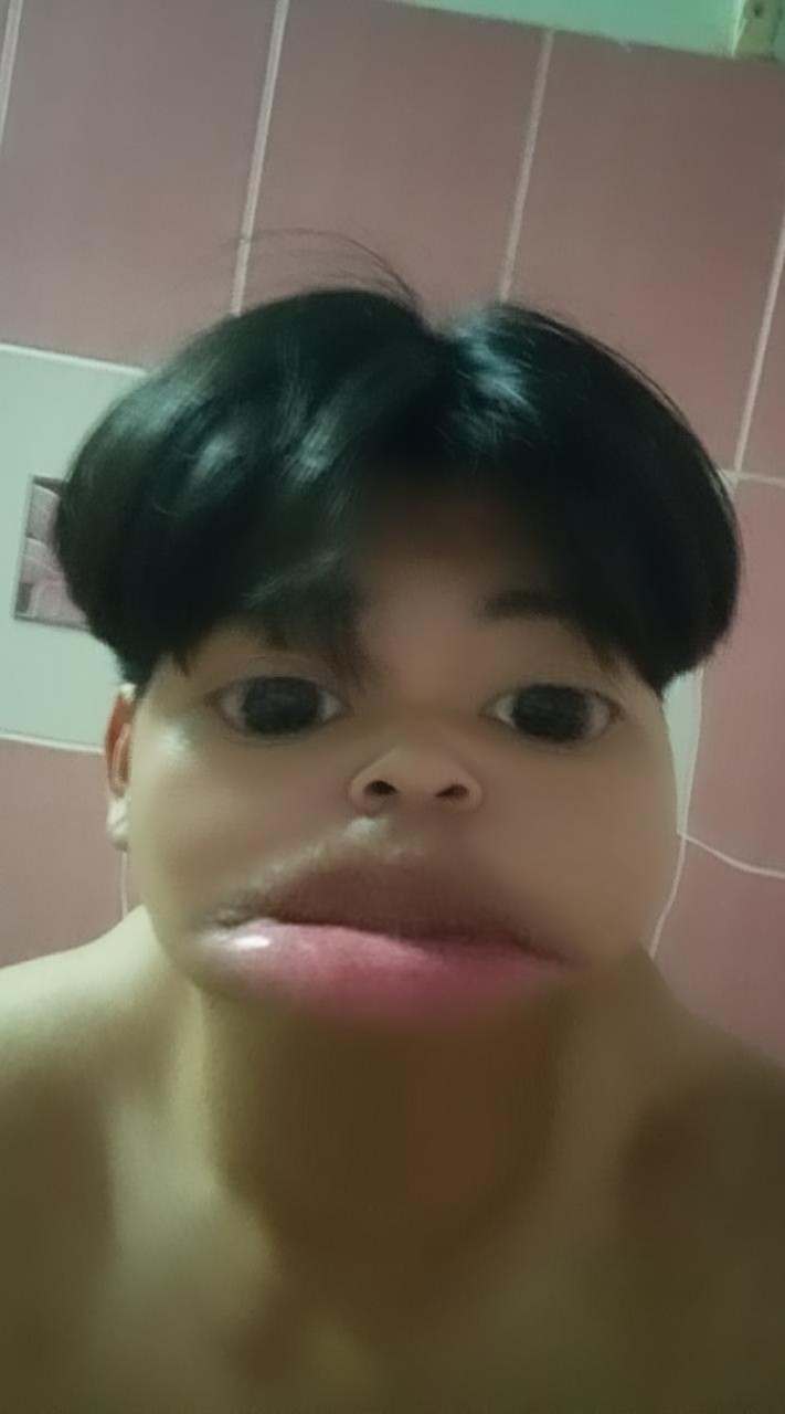 อาร์มเองหมา