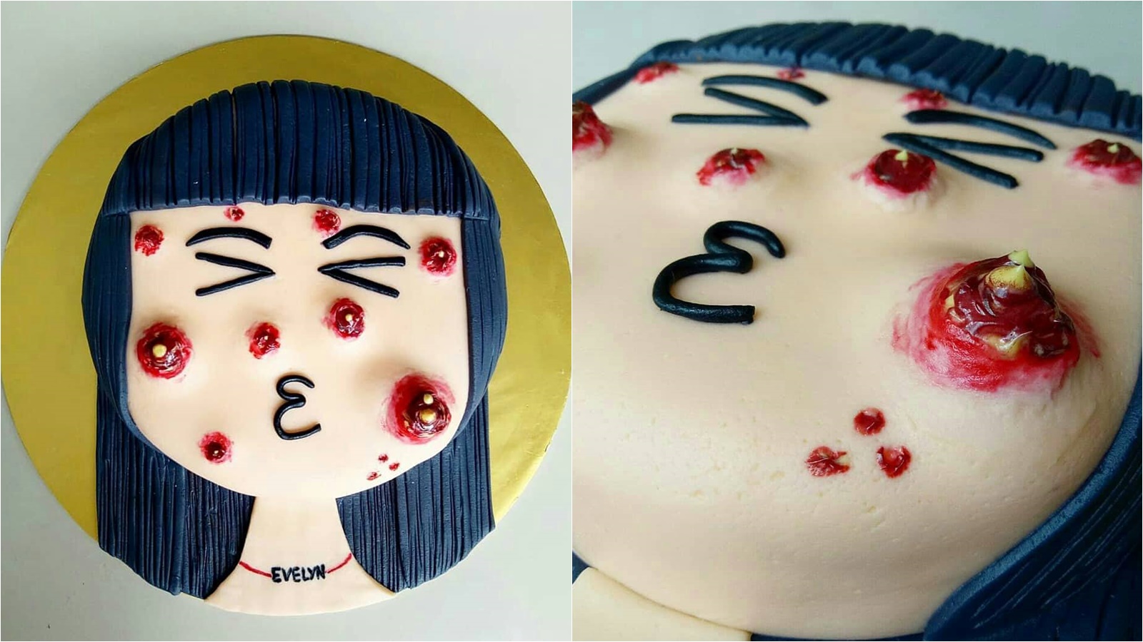 Kini Ada Kue Ulang Tahun Yang Ditumbuhi Jerawat Kini Ada Kue Ulang Tahun Yang Ditumbuhi Jerawat