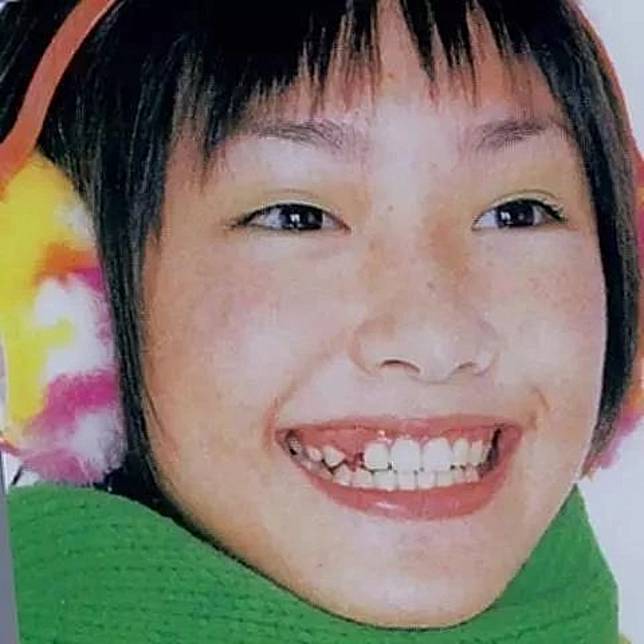 偷偷整容的等級 新垣結衣變身國民老婆前長這樣 日本集合 Line Today