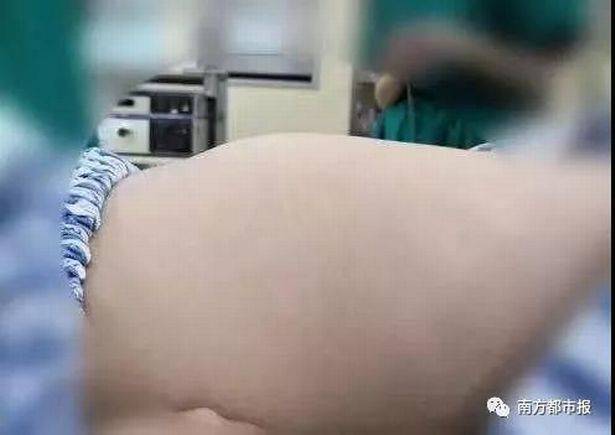 Perut gadis ini berubah membesar karena kebiasaan buruk yang dilakukannya.