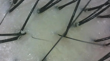 換季頭皮問題好棘手~雪花般的頭皮屑、頭皮飄出油垢味？專家推薦3款草本髮品