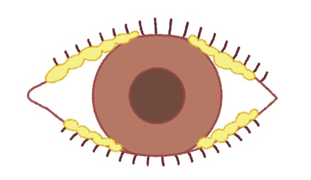 な場合は要注意 知っておきたい 目やに の基礎知識