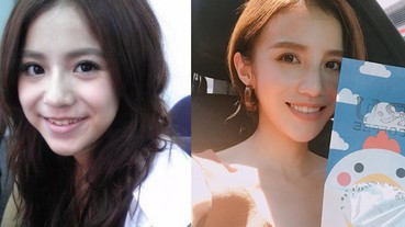 顏值飆升就靠一口整齊漂亮的牙，盤點那些整牙後就像整形的女星～