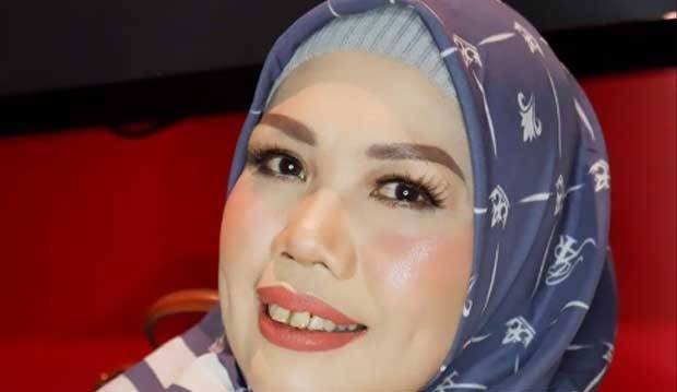 Gigi Tonggos Akhirnya Dipotong Ely Sugigi Bisa Mingkem Gue Sekarang Cumicumi Com Line Today