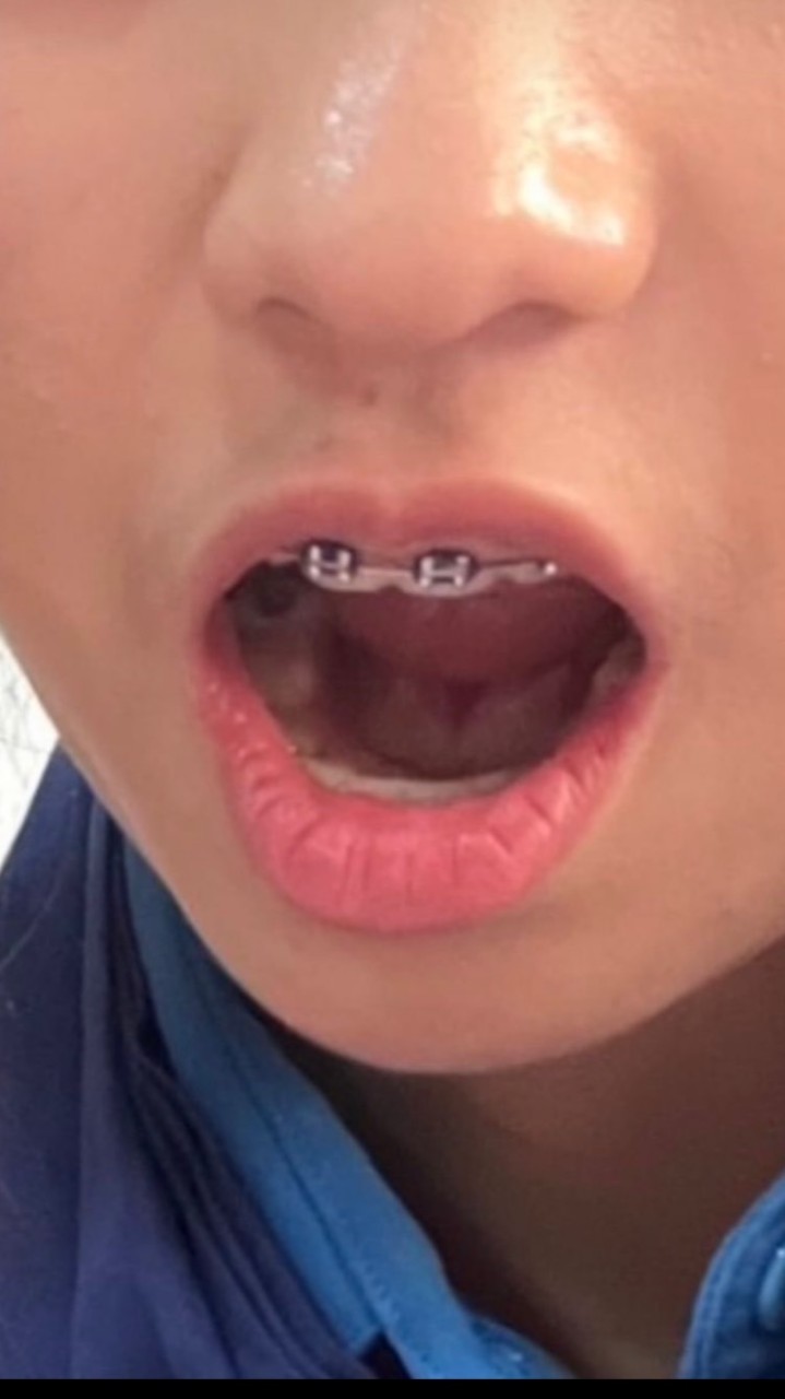 กลุ่มด่า