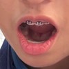 กลุ่มด่า