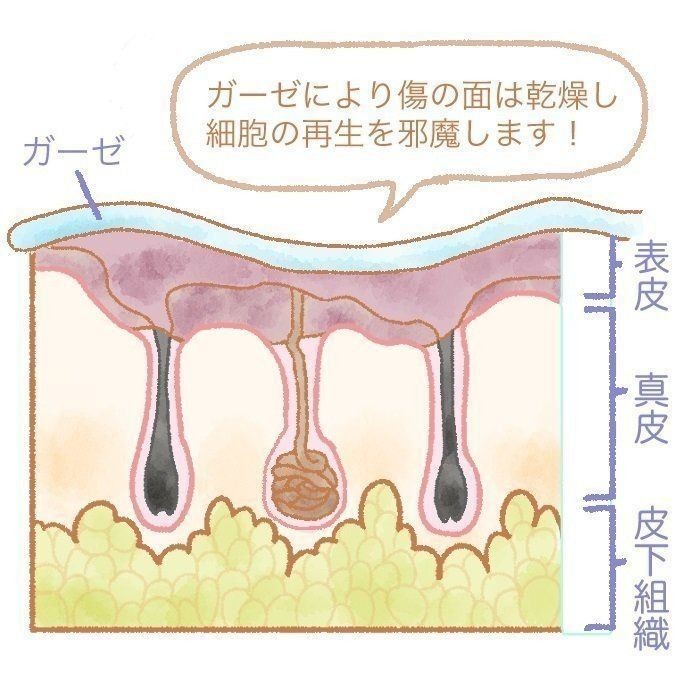 切り傷 すり傷は消毒しない 乾かさない 新しい考え方