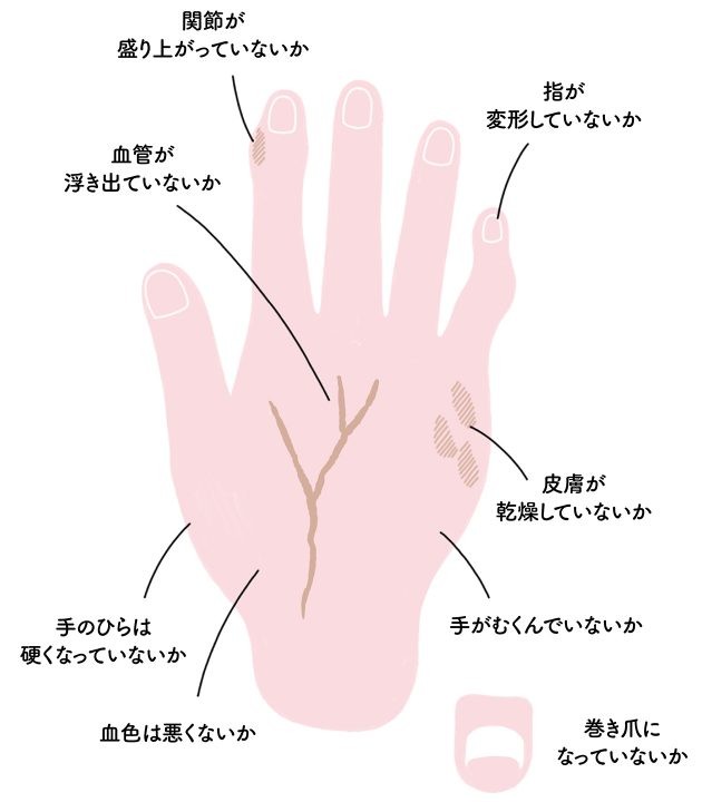 手の指をしっかりほぐして こり 冷え むくみを解消