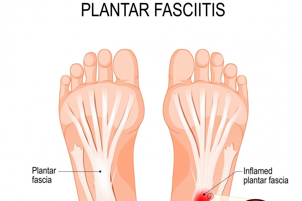 best trail running shoes for plantar fasciitis