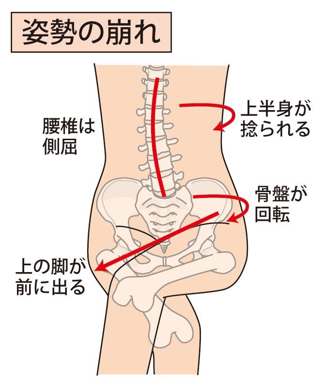 足を組むと骨盤がゆがむ はホント 体の内側で何が起きているのか