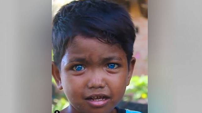 Bocah bermata biru