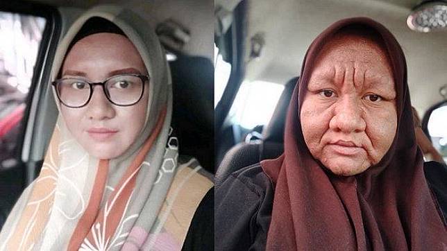 Foto: (Facebook Nor Sahira II)   Artikel ini telah tayang di Tribunsumsel.com dengan judul Kisah Viral Nor Sahira Wajah Berubah Jadi Nenek-nenek Saat Hamil Anak Ketiga, Kenali Penyebabnya!, https://sumsel.tribunnews.com/2020/04/19/kisah-viral-nor-sahira-wajah-berubah-jadi-nenek-nenek-saat-hamil-anak-ketiga-kenali-penyebabnya.  Editor: Moch Krisna