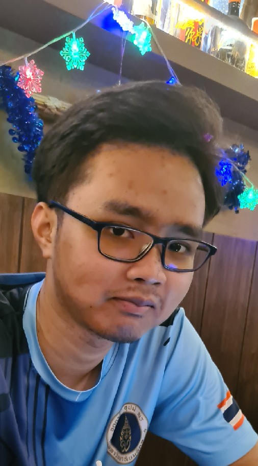 SGD : billous vomiting