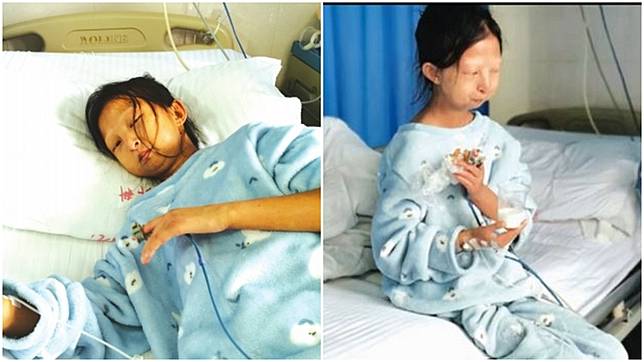 大陸貴州貴陽24歲的吳花燕省錢救弟，不幸病逝。(圖／翻攝自貴州都市報網站、搜狐視頻)