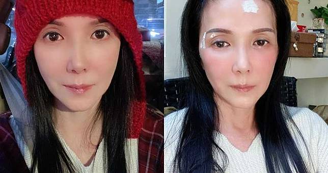 丁國琳年前出意外！女神臉「破相縫5針」　憔悴模樣粉絲超心疼