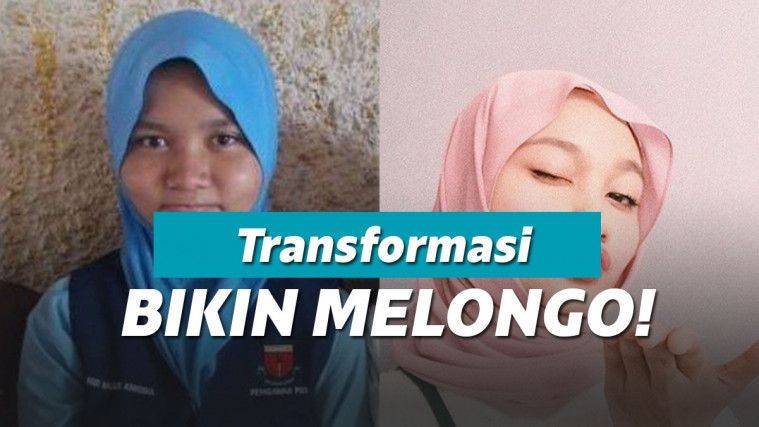 Dulunya Dekil Sekarang Cewek Ini Berubah Jadi Cantik Banget Keepo Me Line Today