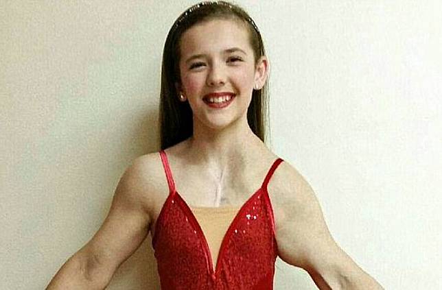 Dengan Menjadi Penari Balet, Gadis Ini Bertarung Melawan Tumor