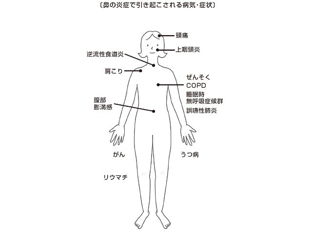放置すると命に関わるものも 鼻の炎症 がもたらす病気とは
