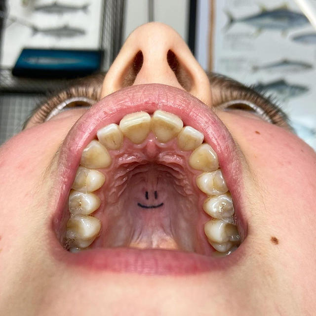 這種超荒謬的刺青位置，的確可以達到自娛娛人的效果！ 