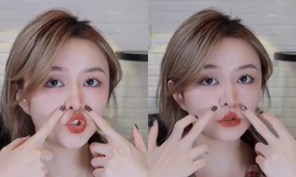 什麼是鼻基底凹陷？