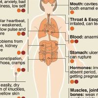 eating disorders