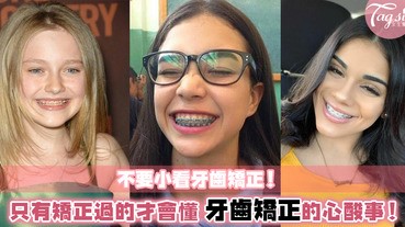 只有做過的人才會懂！牙齒矯正的5件痛苦事！不能吃口香糖已經是小事了～