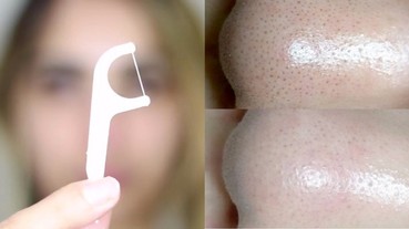 牙線棒原來是黑頭的剋星？這個簡單有效又不傷皮膚的方法，絕對要馬上學！